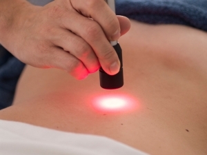 Laserterapia